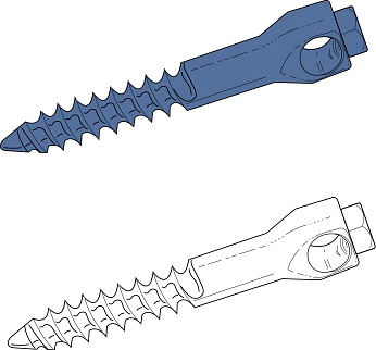screw.jpg